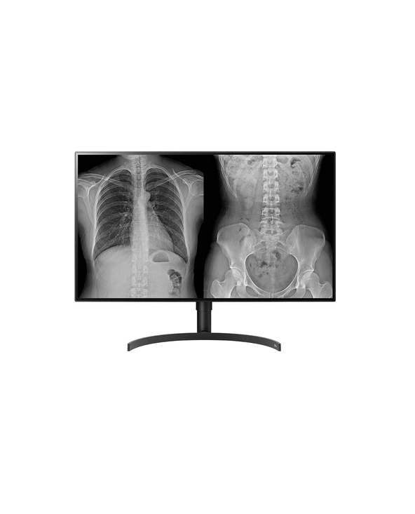 LG 32HL512D-B 31.5 Full HD 14 ms Noir
