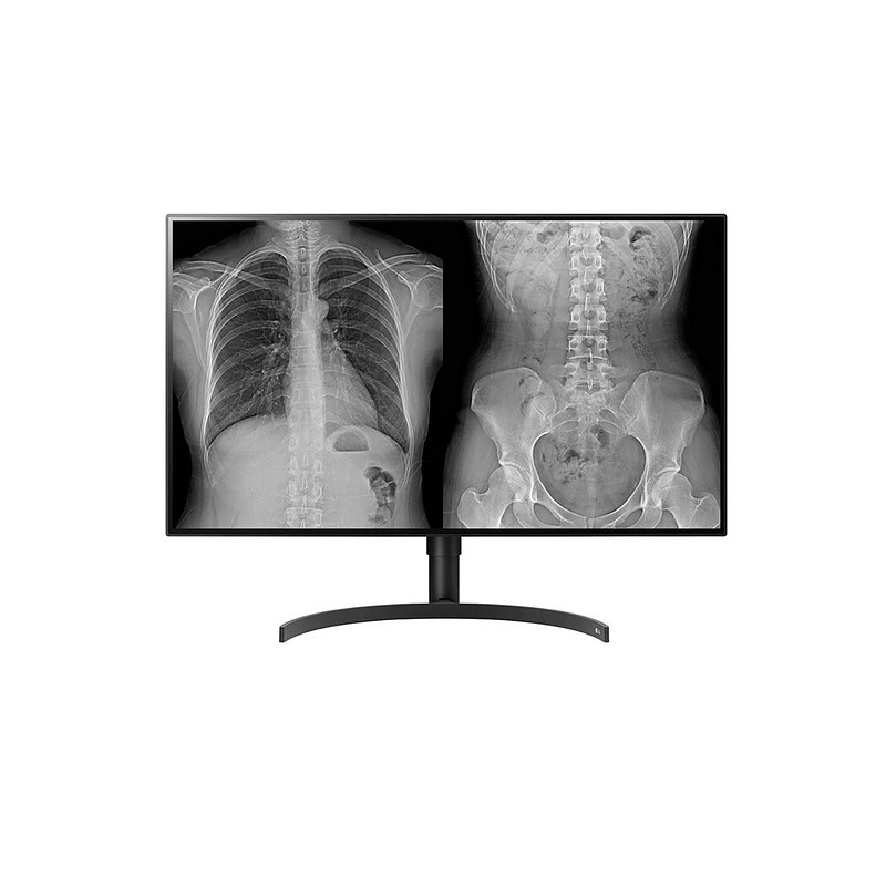 LG 32HL512D-M 31.5" Full HD 14 ms Noir
